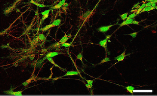 Neurônios derivados de células-tronco embrionárias de camundongos, in vitro, com marcações fluorescentes para verificar sua característica dopaminérgica. Foto cedida pelos pesquisadores.