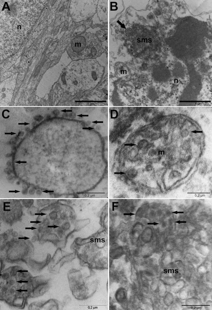 Imagens do trabalho, mostrando células e organelas infectadas pelo zika vírus. Crédito: https://doi.org/10.7287/peerj.preprints.1817v1