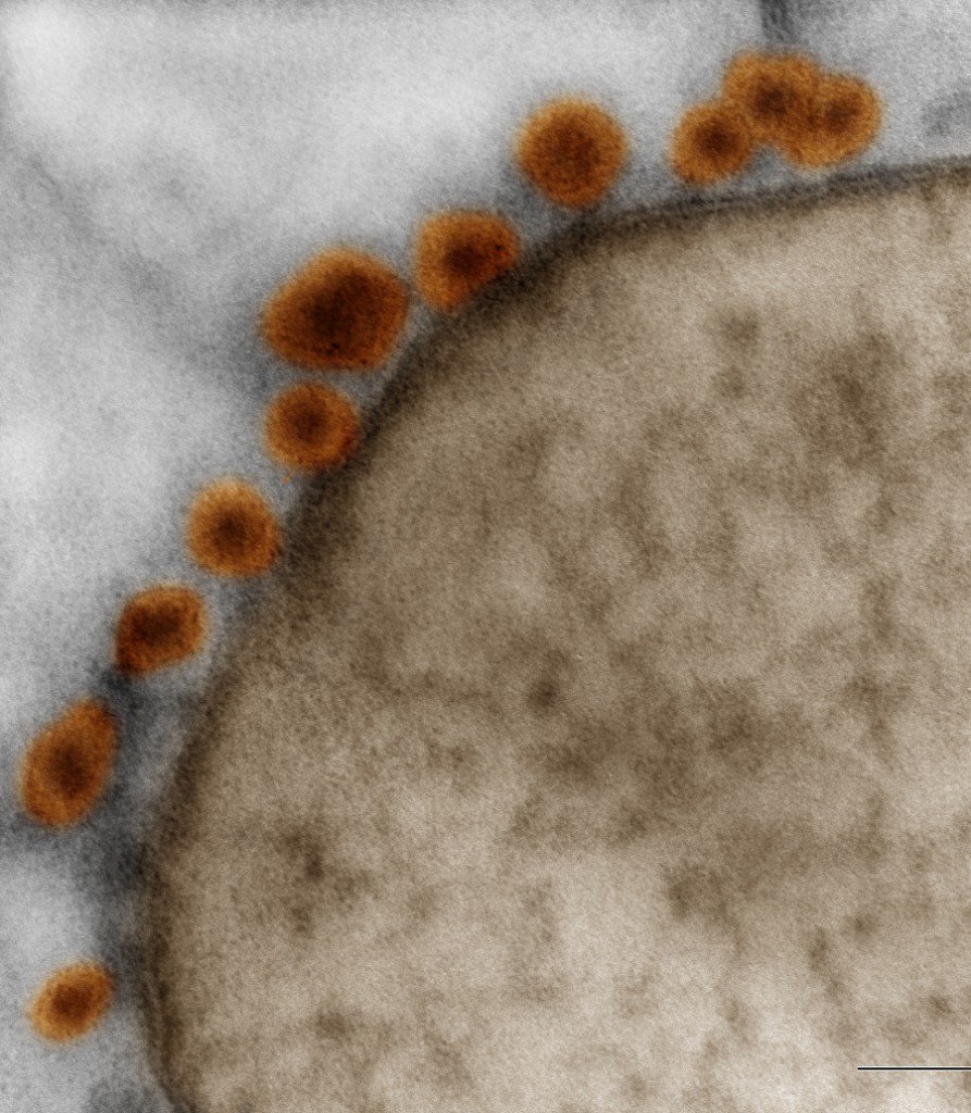 Imagem de microscopia mostra partículas de zika vírus (as bolinhas laranjas) ao redor de uma neuroesfera de células humanas. Crédito: Rodrigo Madeiro/IDOR